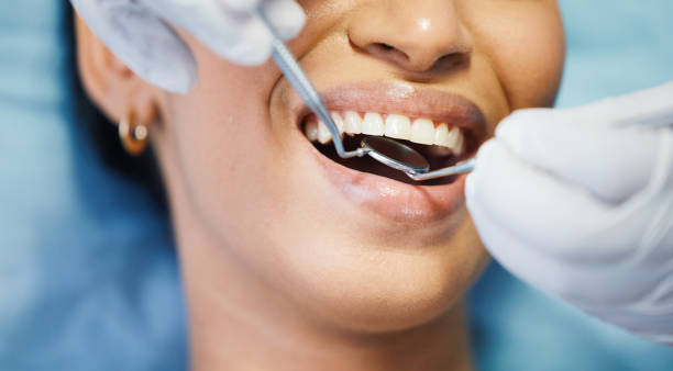 Best Emergency Root Canal Treatment in Granite Hills, CA